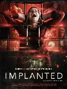 Implanted poster